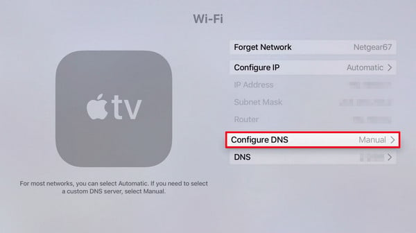 change dns on apple tv